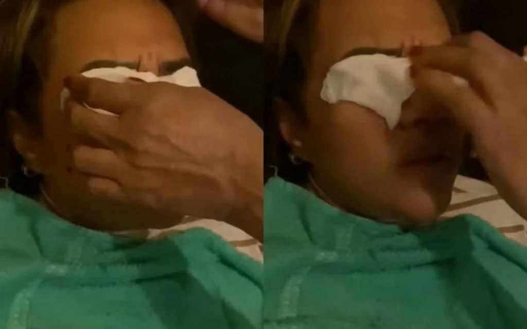 Córneas queimadas e muita dor: consumidoras alertam sobre sérum para os olhos