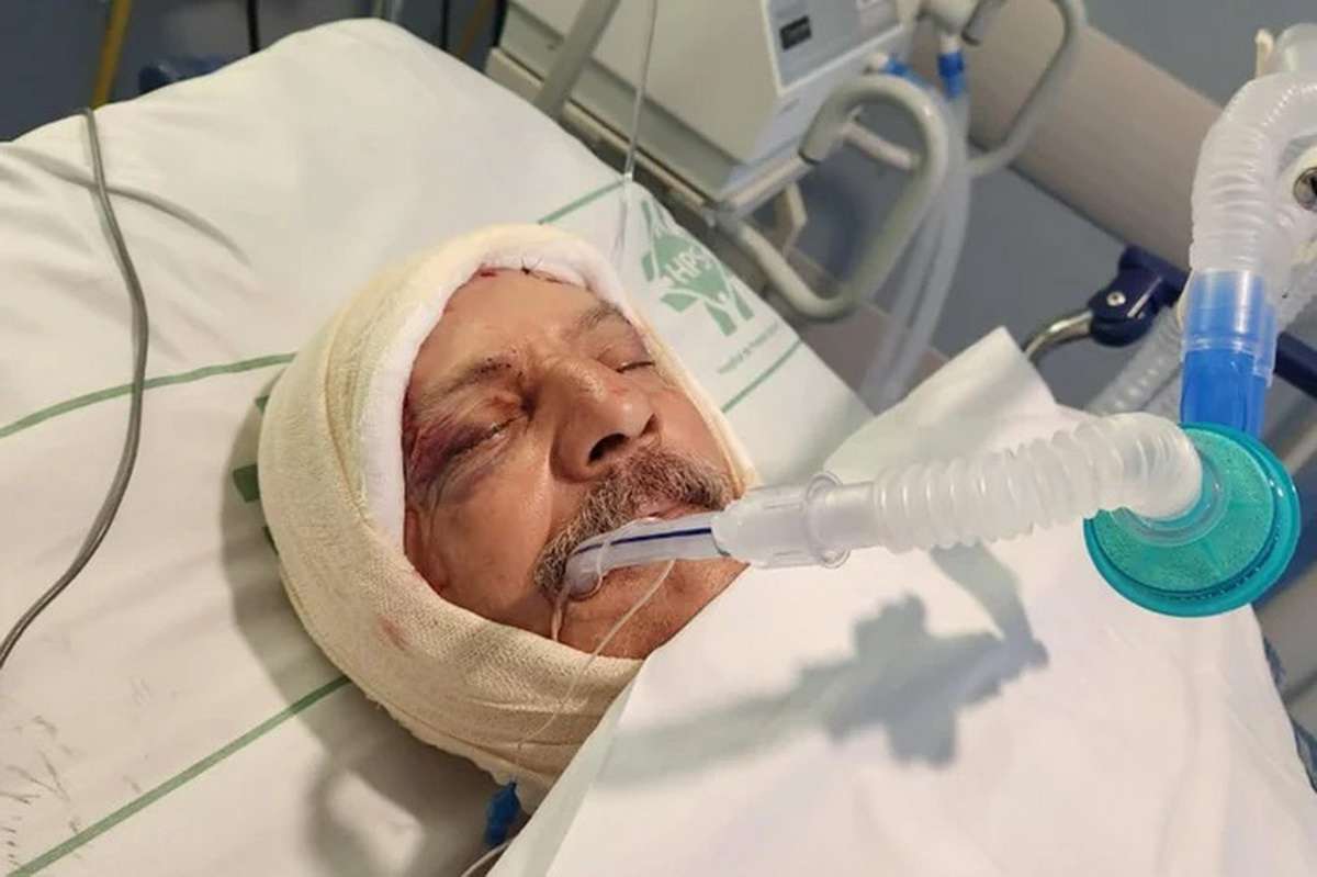 Entregador atacado por 5 cães da raça pitbull no RS está em estado grave