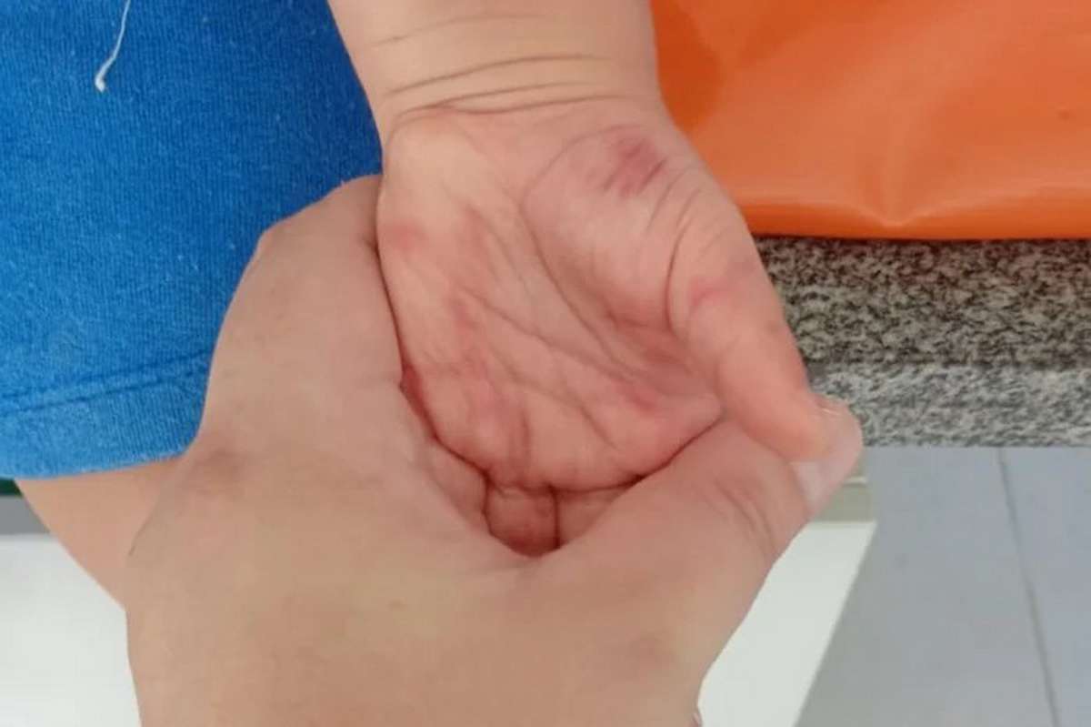 Professoras são afastadas após suspeita de maus-tratos em creche no Litoral Norte